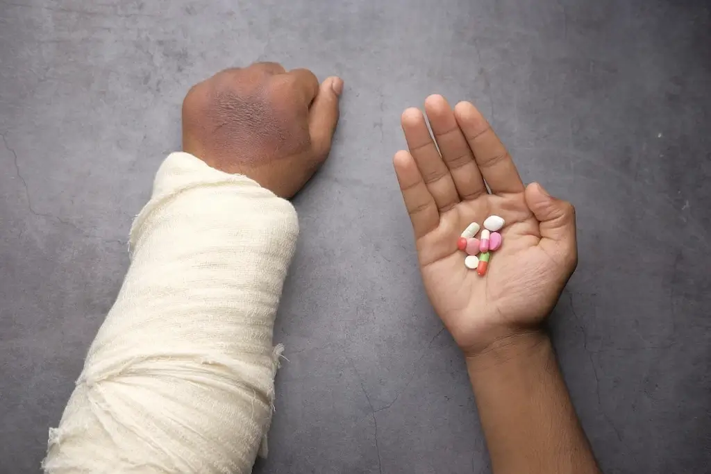 A man with a bandaged broken arm and medication pills.